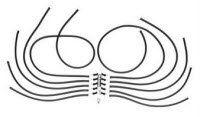 1176402 Cuff Blood Presssure ABI Ea K290 Sold Individually MADE BY Wallach Surgical Devices
