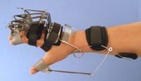 North Coast Medical Combination Oppenheimer Splint, Size: Medium