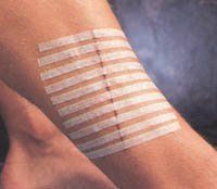 3M-R1540 Strip 1/8x3" Closure Steri-Strip Tan Skin 50/Bx by 3M Part No. R1540