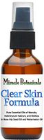 Miracle Botanicals Clear Skin Formula - 100% Pure Essential Oil and Carrier Oil Blend - Therapeutic Grade.60ml/2oz