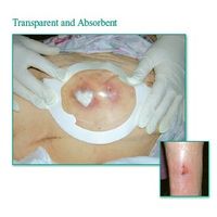 Tegaderm Clear Absorbent Acrylic Dressing 5-9/10" x 6"