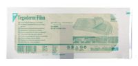 DRESSING TEGADERM 4X10 20/BX4BX/CS 3M TEGADERM TRANSPARENT FILM DRESSING FRAME STYLE
