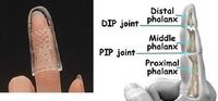 Open Air Stax Finger Splint Size #1