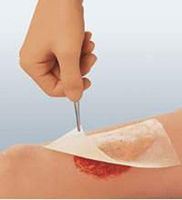 Cuticerin - Impregnated Dressing Cuticerin 7.5 X 7.5 cm Gauze Cuticerin Ointment Sterile - 50/Box - MCK