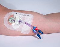 Clik-FIX PICC/Central Catheter Securement (Foam)