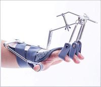 XIGUAN Finger Trainer Device, Flexible Finger Training to Restore Wrist Braces, Suitable for Stroke Hemiplegia (Color : Gray)