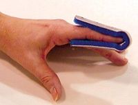 Fold Over Finger Splint Medium Bulk PK/6 Non-Retail
