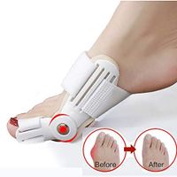 MNBHJK 2PCS Bunion Corrector Toe Splint Kit | Pain Relief & Correction | Hallux Valgus & Bunion Pads, Splints, Straightener & Protector | Medical Grade