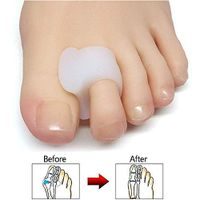 XCBW Toe Separators for Bunions,10Pcs /Big Toe Straightener Protector Splint– Immediate Foot Pain Relief Wear with Shoes Spacer,L