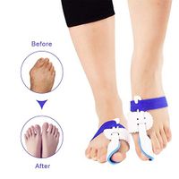 Bunion Corrector Bunion Splints and Big Toe Straighteners Adjustable Orthotics Toe Separators for Hallux Valgus Pain Relief Bunion Treat and Prevent,Blue