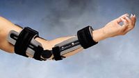 Progress Elbow Hinge Splint Small/Medium