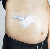 Shower Shield 8" x 8" PICC Line Cover Moisture Barrier，Wound Dressing -One Week Supply (7 Pack)