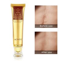 Spdoo Scar Acne Mark Removal Gel Ointment Skin Repair Blemishes Treatment Whitening Skin Care Cream, 30g