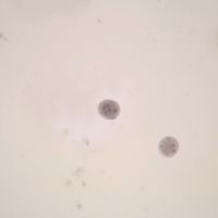 Entamoeba coli Cysts, Smear Microscope Slide