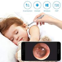 Digital Otoscope, Mbaoluo Upgraded 3.9mm Ultra-Slim HD Ear Scope Ear Inspection Camera, Ear Otoscope Earwax Cleaning Tool with 6 Adjustable LED Lights for Android and Windows & Mac.