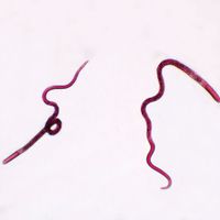Trichinella spiralis Female, w.m. Microscope Slide
