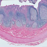 Human Appendix, c.s. sec. 7 m H&E Microscope Slide