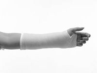 3M Health Care 82005B Plus Casting Tape, 5" x 4 yd. Size, Blue (Pack of 10)