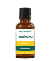 Frankincense Essential Oil