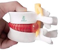 Doc.Royal Anatomical Human Lumbar Vertebrae Degenerative Lumbar Human Spine Model 1PCS