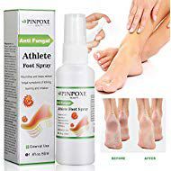 Foot Spray, Natural formula, Athletes Foot, Ringworm, Jock Itch and Foot Infections. Effectively Soothes in Minutes-Fights Against