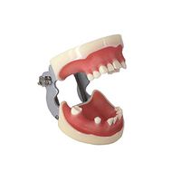 Healifty Teeth Model Dental Implant Practice Model with Soft Gum Dentist for Medical Dental Education Practice Teaching Study