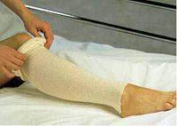 AlbaHealth Stockinette Tubular, 4 Inch X 25 Yard Cotton NonSterile, 81420 - Sold by: Pack of ONE