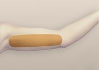 Oleeva Brachioplasty Shape (Each) by Oleeva