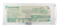 DRESSING TEGADERM 4X10 20/BX4BX/CS 3M TEGADERM TRANSPARENT FILM DRESSING FRAME STYLE