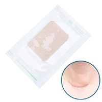 Teemint 5cm x 3.5cm x 2mm Skin color Scar Away Patch Silicone Gel Sheet Wound Marks Removal Cesarean Keloid Skin Scars Therapy Treatment