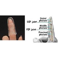 STAX Finger Splint - Size 5 - Clear