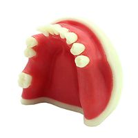 LXX Dental Adult Teeth Model - Mandibular Missing Tooth Model Implant Dentist Dental Model Standard Teaching Model