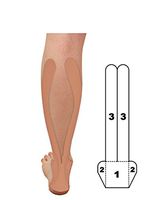 Kindmax Precut Application 5 Pack