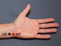 Hot Flash Relief, Menopause Bracelet, Hot Flush Bracelet, Sleep Bracelet, Emotion Bracelet (Single Band) White (Large 8 in)