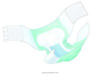 Wings Bariatric Adult Brief, Wings Bariatric Adl Brf, (1 CASE, 32 EACH)