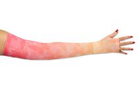 Lympediva Butterfly Meadow Compression Armsleeve Only (hand not included) Short 30-40 mmHg Medium
