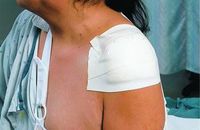 (BX) 3M Microfoam Tape