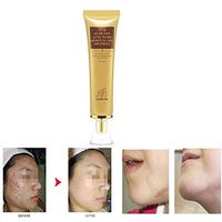 Fheaven (TM) 30ml Removing Scar Ointment Acne Scar Removal Cream Skin Repair Face Cream Acne Spot Treatment