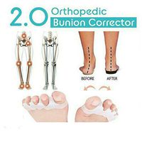 Beette 2019 Orthopedic Bunion Corrector 2.0 (1 Pair)