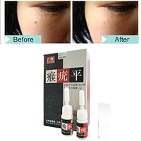 Taykoo Mole & Skin Tag Removal Solution Kit Painless Mole Skin Dark Spot Removal Face Wart Tag Freckle Removal Cream Oil