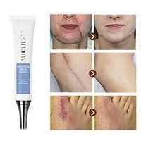 DMZ Soft Cream Freckle Cream Extract Acne Removal Scars Marks Treatment Facial 20g