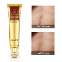 4PCS Scar Removal Cream Scar Repair Gel Acne Scar Treatment, Stretch Mark Removal Gel Ointment for Burns Cuts Pregnancy Body Scars Acne Spots Repair