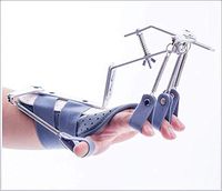 XIGUAN Finger Trainer Device, Flexible Finger Training to Restore Wrist Braces, Suitable for Stroke Hemiplegia (Color : Gray)