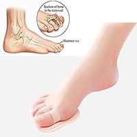 Hammer Toe Straightener Overlapping Toes Bunion and Toe Big Little Thumb Separator