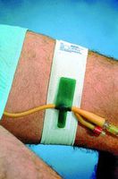 Special 1 Pack of 3 - Foley Catheter Holder DAL316 DALE MEDICAL PRODUCTS by MedC