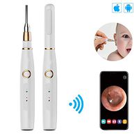 flydragonsuper Smart Ear Spoon 720P Million Hd,Ear Canal Endoscope with 6 LED Lights,Otoscope with 12 Replacement Heads Included,Suitable for Windows,Apple Computer and All Smartphone Tablets-3.9mm