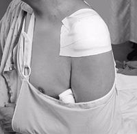 3M Medical Tape MicrofoamElastic Foam 2" X 5-1/2 Yards NonSterile (#1528-2, Sold Per Box)