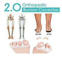 2019 2PCs Orthopedic Bunion Corrector 2.0 5 Toe Separator