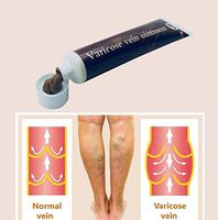 Preciashopping Varicose Veins Treatment Cream Effective Cure Vasculitis Phlebitis Spider Veins Pain Varicosity Angiitis Ointment Health Care
