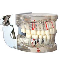 LXX Dental Implant Disease Teeth Model Student Teaching Tooth Model Transparent Adult Comprehensive Oral Pathology Teaching Tool Toy